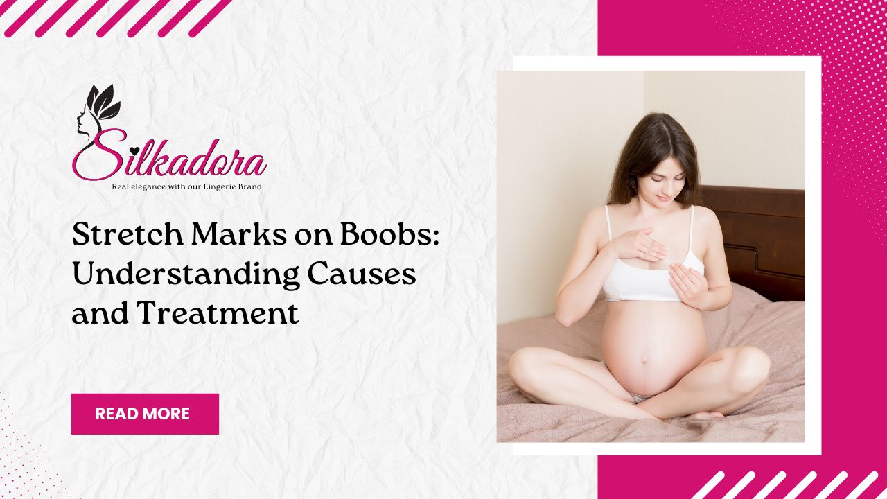 Stretch Marks on Boobs: Understanding Causes and Treatment